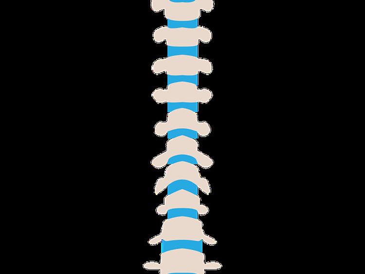 脊椎滑脱怎么治？分情况选对方法是关键(图1)