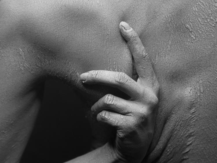 拔完火罐后背痒？3个原因+正确应对方法(图1)