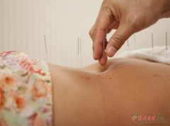 经期艾灸肚脐：3种情况科学判断，避免不适 - 深圳健康科普资讯网