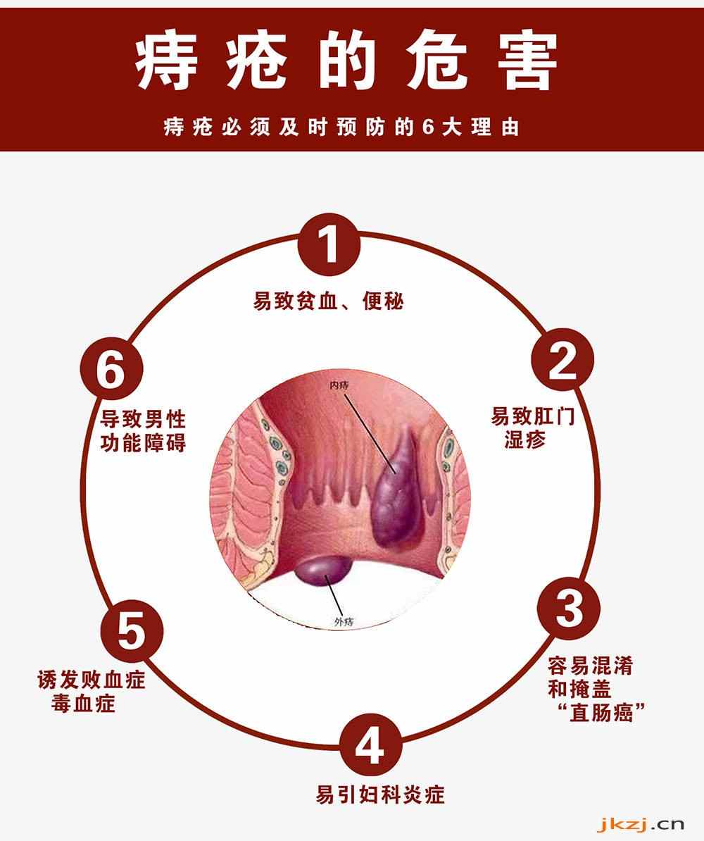 十男九痣，十女十痔得了痔疮坐立难安，吕易圣痔疮灵，无需微创只需一洗一抹(图2)