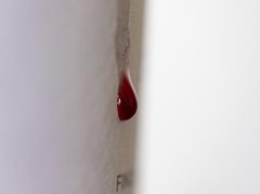 中医如何判断痛风？3个核心维度帮你精准识别 - 深圳健康科普资讯网