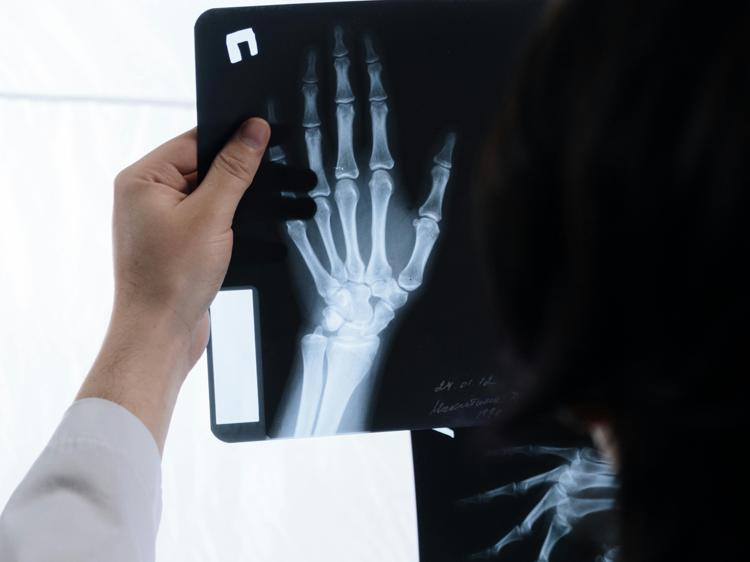 骨折愈合别靠感觉!科学判断避免二次损伤(图1) 骨折愈合别靠感觉!科学判断避免二次损伤(图1)