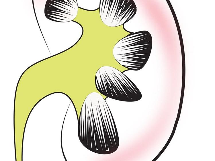 爱出汗燥热是肾阴虚？未必！这4点要分清(图1)