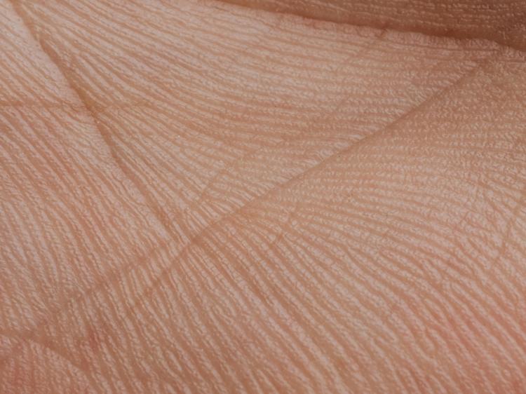 手掌光滑是肝肾亏虚？别被误导！3个科学判断法(图1)
