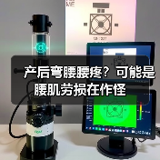 产后弯腰腰疼？可能是腰肌劳损在作怪(图3)