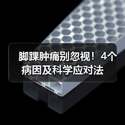 脚踝肿痛别忽视!4个病因及科学应对法(图3) 脚踝肿痛别忽视!4个病因及科学应对法(图3)