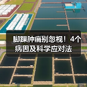 脚踝肿痛别忽视!4个病因及科学应对法(图4) 脚踝肿痛别忽视!4个病因及科学应对法(图4)