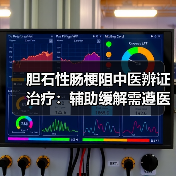 胆石性肠梗阻中医辨证治疗:辅助缓解需遵医嘱(图2) 胆石性肠梗阻中医辨证治疗:辅助缓解需遵医嘱(图2)
