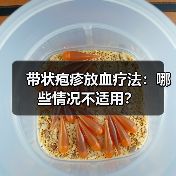 带状疱疹放血疗法:哪些情况不适用?(图2) 带状疱疹放血疗法:哪些情况不适用?(图2)