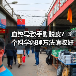 血热导致手脚脱皮?3个科学调理方法请收好(图1) 血热导致手脚脱皮?3个科学调理方法请收好(图1)