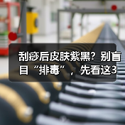 刮痧后皮肤紫黑?别盲目“排毒”,先看这3个信号(图1) 刮痧后皮肤紫黑?别盲目“排毒”,先看这3个信号(图1)