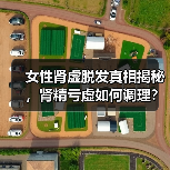 女性肾虚脱发真相揭秘,肾精亏虚如何调理?(图2) 女性肾虚脱发真相揭秘,肾精亏虚如何调理?(图2)