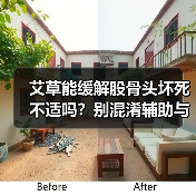 艾草能缓解股骨头坏死不适吗？别混淆辅助与治疗(图3)