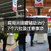 肩周炎拔罐辅助治疗:7个穴位及注意事项(图4) 肩周炎拔罐辅助治疗:7个穴位及注意事项(图4)