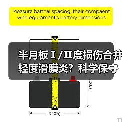 半月板Ⅰ/Ⅱ度损伤合并轻度滑膜炎？科学保守治疗这样做更有效(图1)