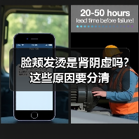 脸颊发烫是肾阴虚吗?这些原因要分清(图1) 脸颊发烫是肾阴虚吗?这些原因要分清(图1)