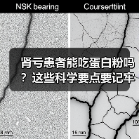 肾亏患者能吃蛋白粉吗?这些科学要点要记牢(图4) 肾亏患者能吃蛋白粉吗?这些科学要点要记牢(图4)