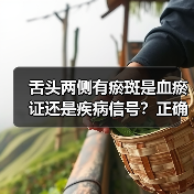 舌头两侧有瘀斑是血瘀证还是疾病信号?正确应对方法来了(图1) 舌头两侧有瘀斑是血瘀证还是疾病信号?正确应对方法来了(图1)