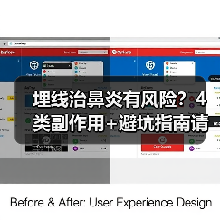 埋线治鼻炎有风险?4类副作用+避坑指南请收好(图2) 埋线治鼻炎有风险?4类副作用+避坑指南请收好(图2)