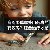 肩周炎单靠外用药真的有效吗?综合治疗才是关键(图2) 肩周炎单靠外用药真的有效吗?综合治疗才是关键(图2)