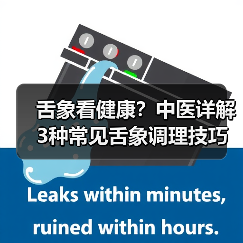 舌象看健康?中医详解3种常见舌象调理技巧(图1) 舌象看健康?中医详解3种常见舌象调理技巧(图1)