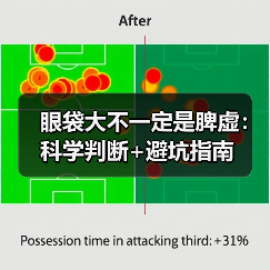 眼袋大不一定是脾虚:科学判断+避坑指南(图4) 眼袋大不一定是脾虚:科学判断+避坑指南(图4)