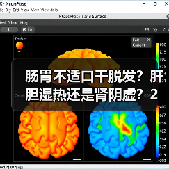 肠胃不适口干脱发?肝胆湿热还是肾阴虚?2个关键鉴别,别再乱调!(图4) 肠胃不适口干脱发?肝胆湿热还是肾阴虚?2个关键鉴别,别再乱调!(图4)