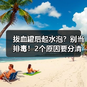 拔血罐后起水泡？别当排毒！2个原因要分清 - 辰飞雨深圳健康科普资讯网
